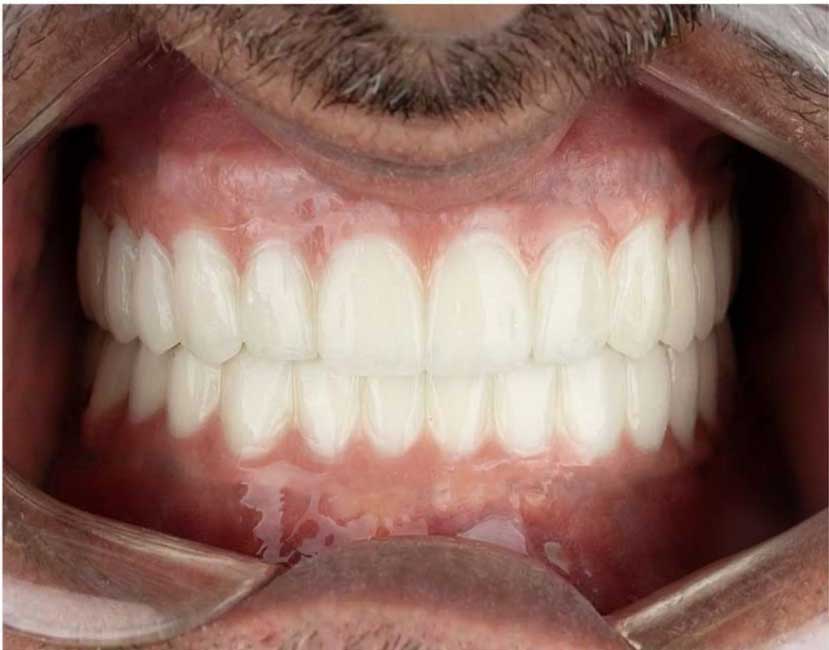 بعد از درمان